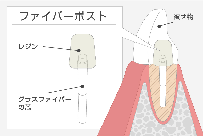 ファイバーコア