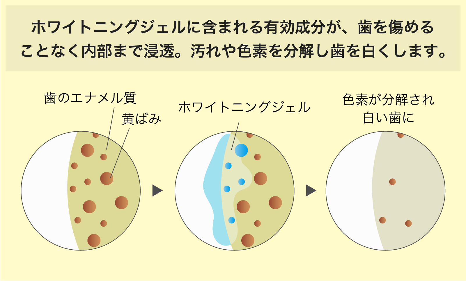 ホワイトニングの仕組み
